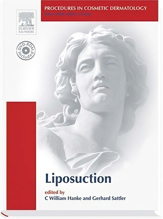 Procedures in Cosmetic Dermatology Series: Liposuction