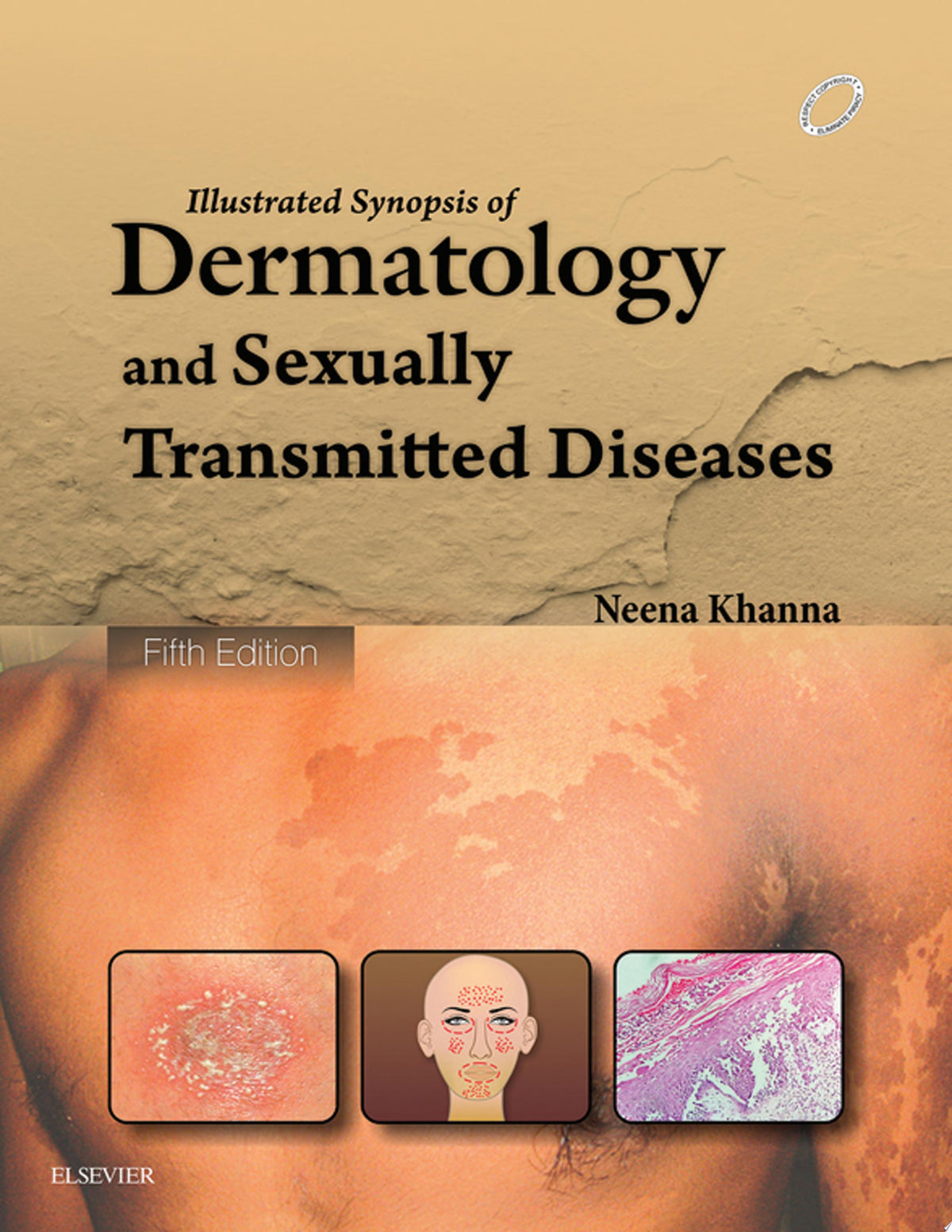 Illustrated Synopsis of Dermatology & Sexually Transmitted Diseases - E-book 5th Edition