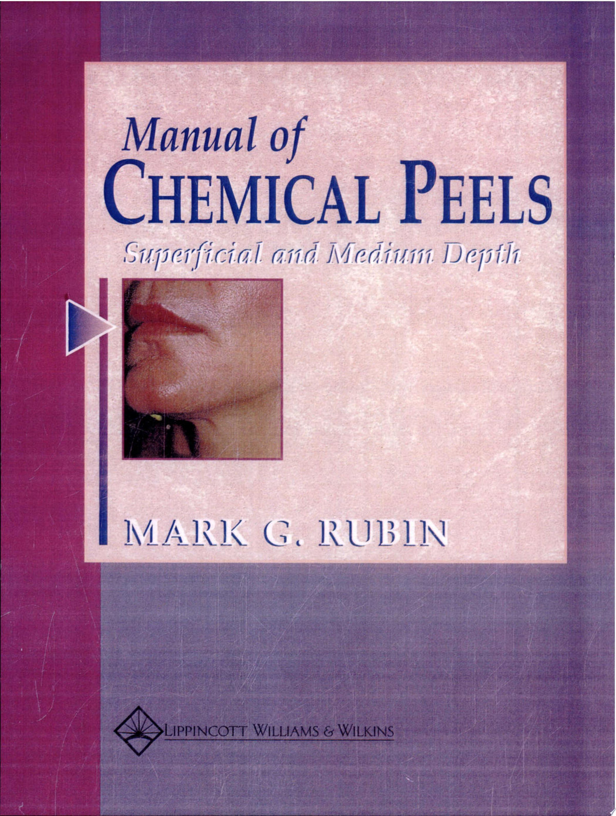 Manual of Chemical Peels: Superficial and Medium Depth