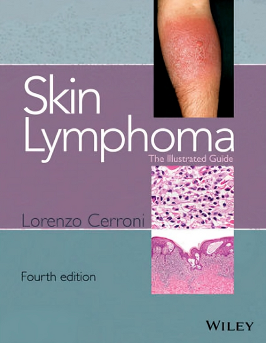 Skin Lymphoma: The Illustrated Guide, 4th Edition