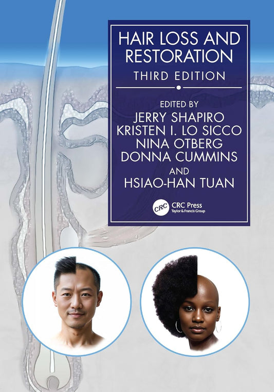 Hair Loss and Restoration, 3rd Edition
