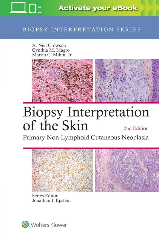 Biopsy Interpretation of the Skin: Primary Non-Lymphoid Neoplasms of the Skin 2nd Edition