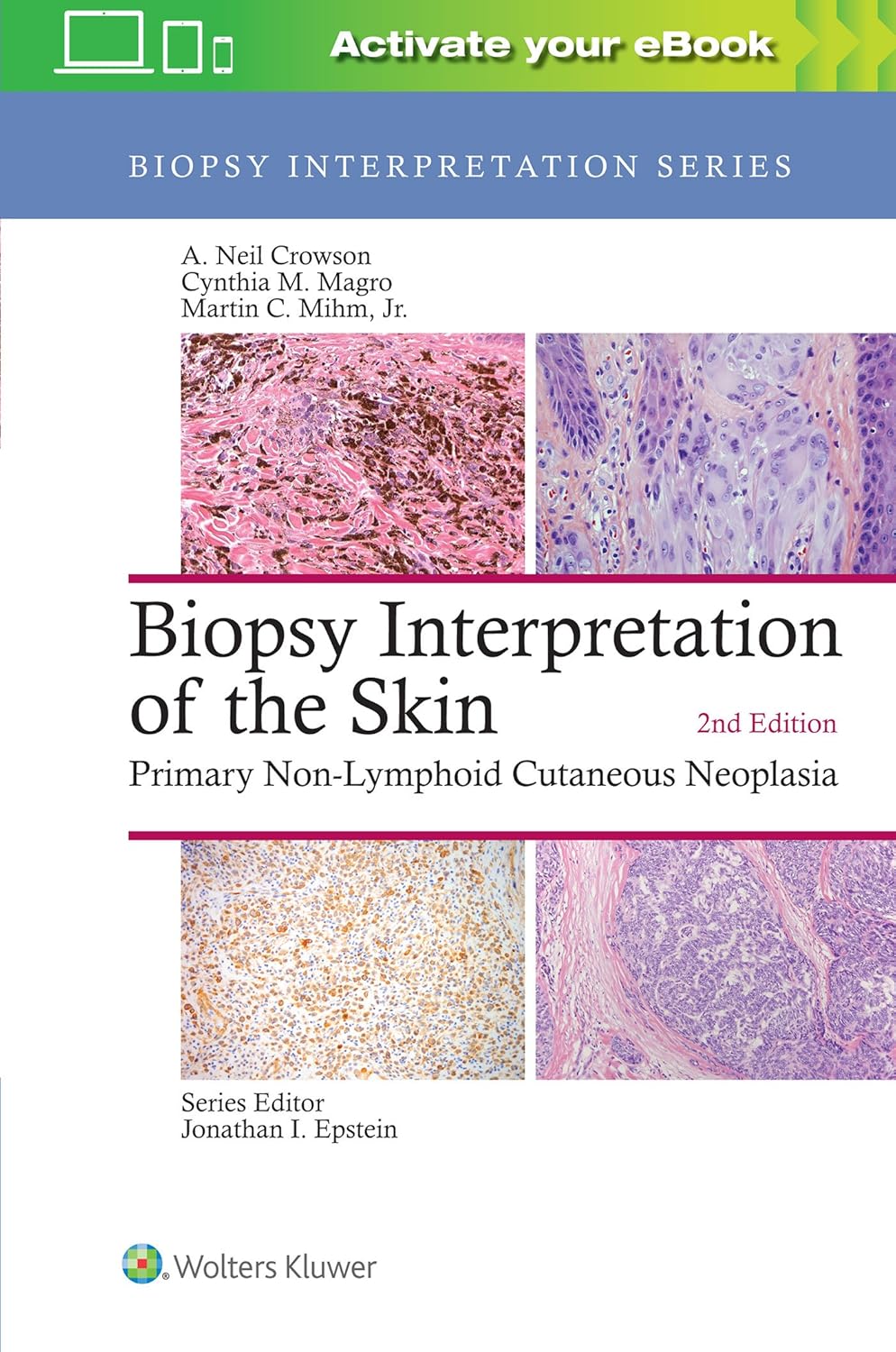 Biopsy Interpretation of the Skin: Primary Non-Lymphoid Cutaneous Neoplasia, 2nd Edition