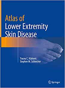 Atlas of Lower Extremity Skin Disease